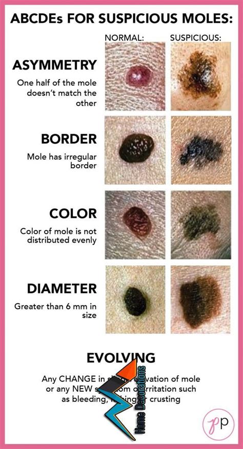 atypical moles that develop into skin cancer